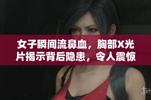 女子瞬间流鼻血，胸部X光片揭示背后隐患，令人震惊的健康警示